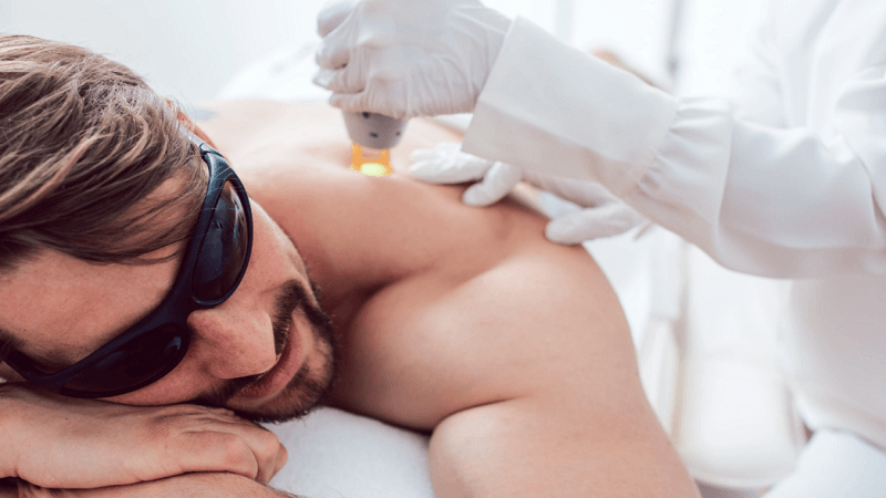Men's Laser Hair Removal: How Athletes and Professionals Are Redefining Male Grooming